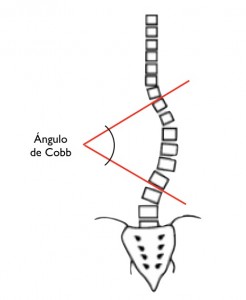angulo-de-cobb